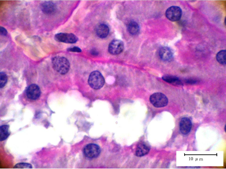Fig. 2  Corteza renal de rata experimental 8 sem. Tbulos proximales de aspecto normal. PAS/H. 3000X.